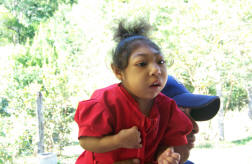 Girl with microcephaly (small brain) is carried to clinic by her father